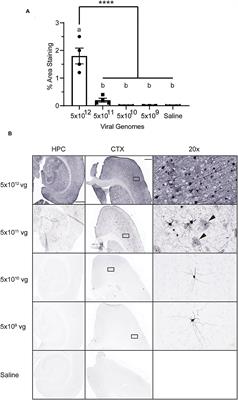 Toward Development of Neuron Specific Transduction After Systemic Delivery of Viral Vectors